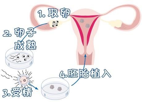 张医生